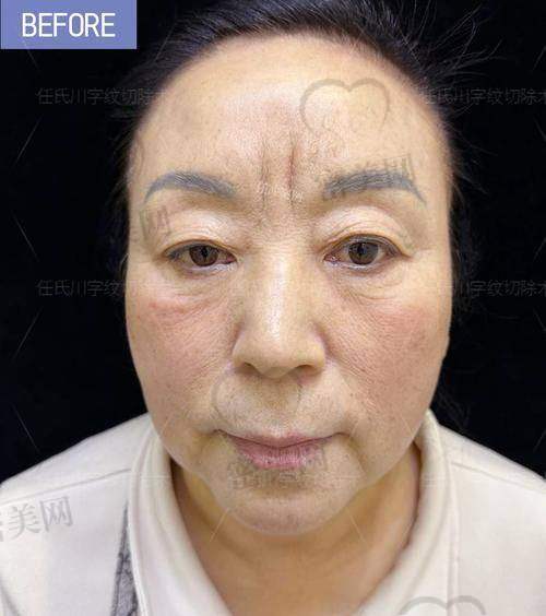 各项目的优缺点