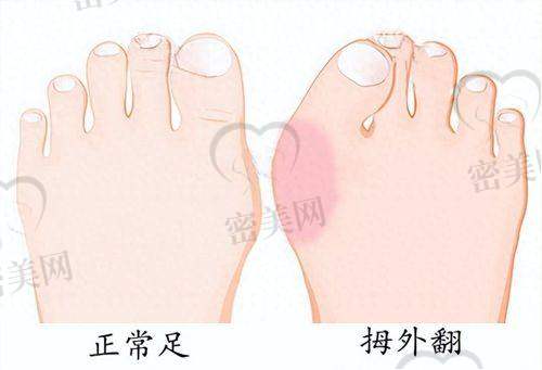 何贤清医生口碑怎么样？