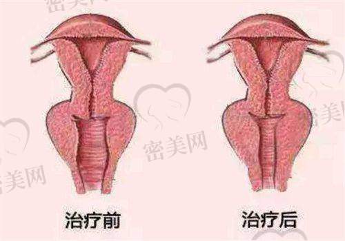 王明刚医生怎么预约挂号？