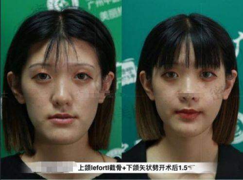 芜湖协和医院整形美容科——低调实力派的变得更美科室