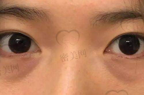 深圳鹏程医院医学美容科——谢福庚医生的个性之美