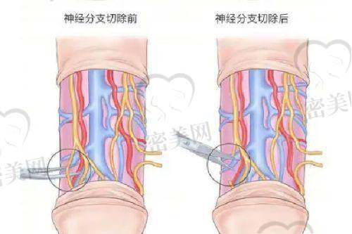 广西玉林华美医疗美容门诊部——杨永成医生掌舵