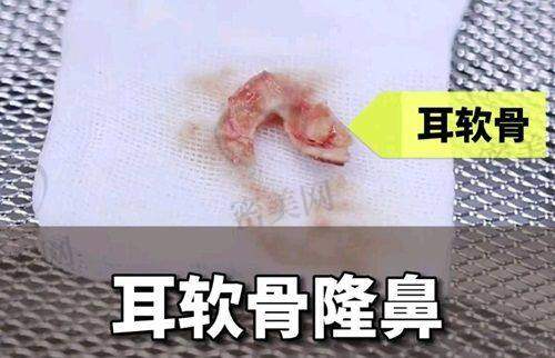 排名第三：东莞缔美美容医院