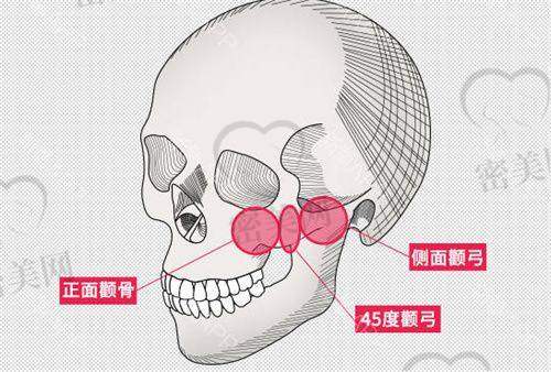 上海愉悦美联臣医疗美容医院——洪性范医生掌舵