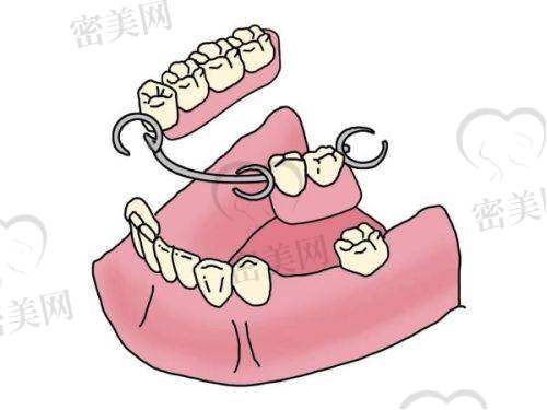 上海新隆口腔门诊部擅长什么项目：