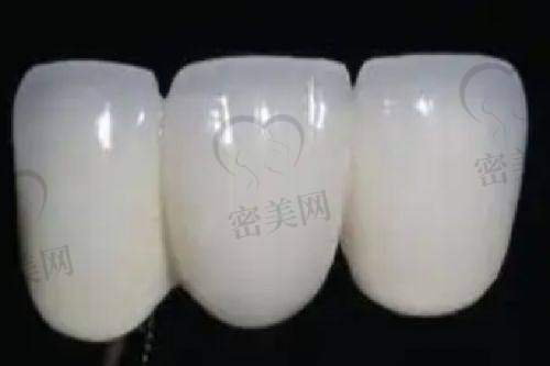 上海博业口腔门诊部擅长什么项目：