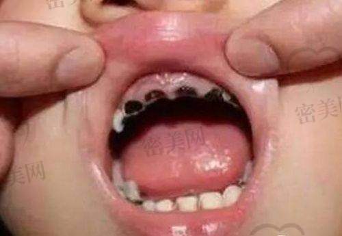 服务体验也是昆明团圆口腔的一大亮点，就诊过程超贴心！