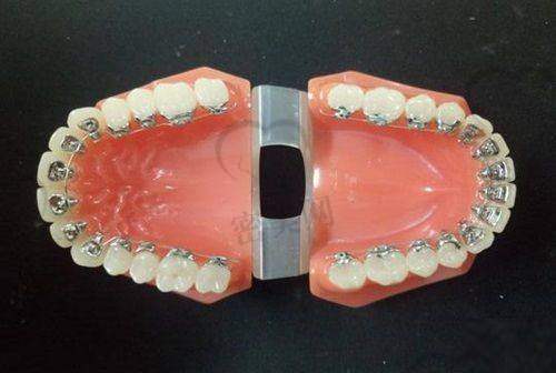 上海李秋华口腔诊所是正规的吗？