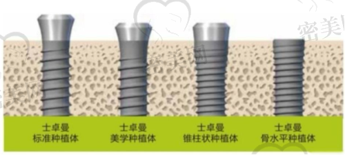 上海丽泽口腔门诊部是正规的吗？