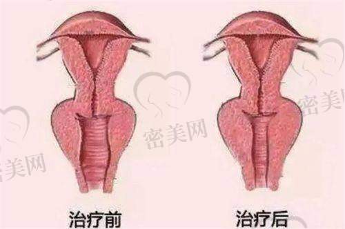 西安米兰柏羽医学美容医院：优雅舒适的变得更美环境