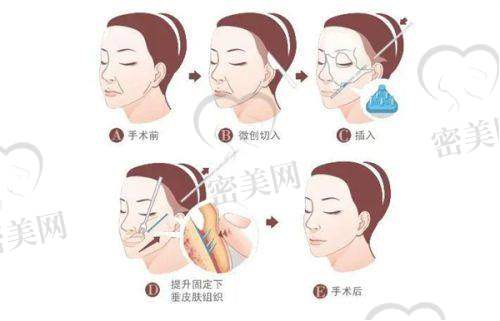 干立平医生口碑怎么样？