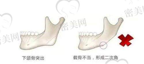 卢正义医生擅长项目：