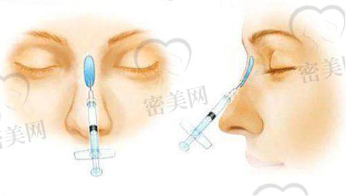 广西梧州华美医疗美容门诊部——刘庆医生把关