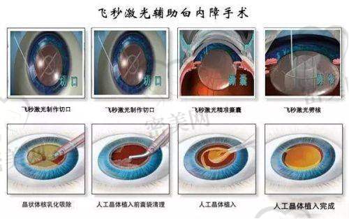 深圳阳光整形美容医院——罗志敏医生的稳定之美