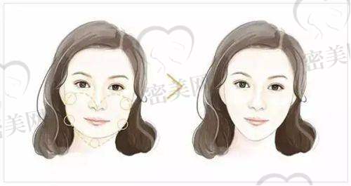 芜湖韩美整形美容医院——融合韩式风格的变得更美之地