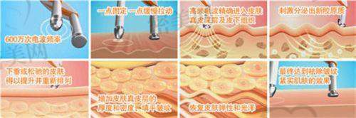盛健康医生擅长项目：