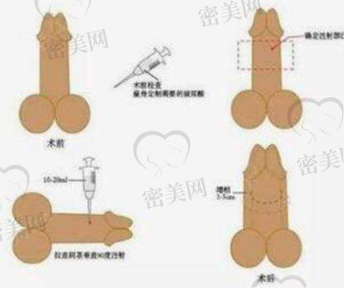干立平医生荣誉资质：