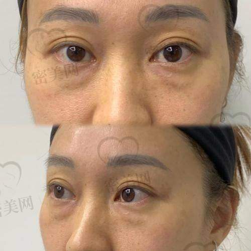 北京米扬丽格医疗美容——“秘诀”在个性化脂肪重塑