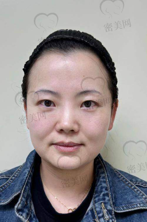 总结：变得更美之旅，选对医生特别重要