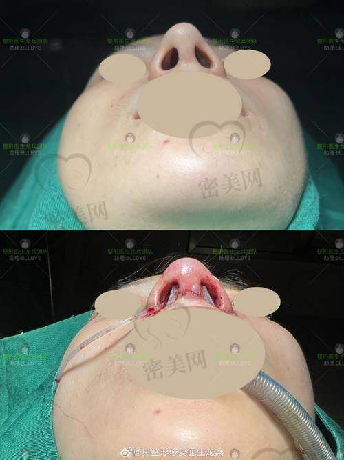 宝藏医生谈宇腾：上海伯思立的美鼻魔法师