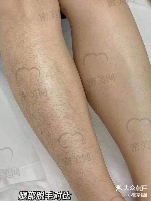 重庆华美整形美容医院