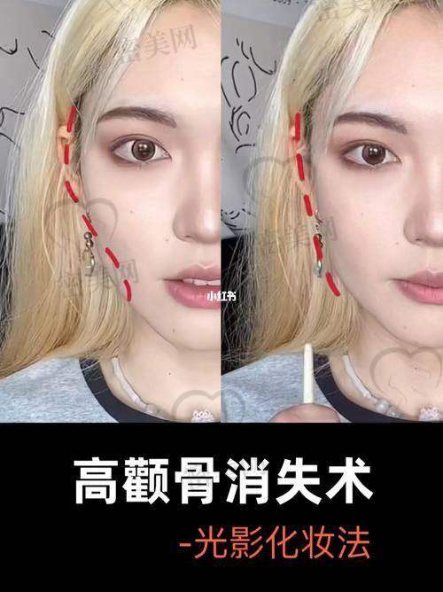 上海华美李志海擅长手术大盘点：这技能点满了！