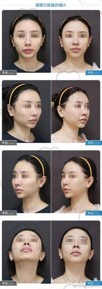 上海华美李志海提前多久预约？先来了解下这位宝藏医生
