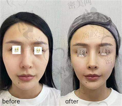 卜双燕医生｜高清实例直观审美实力