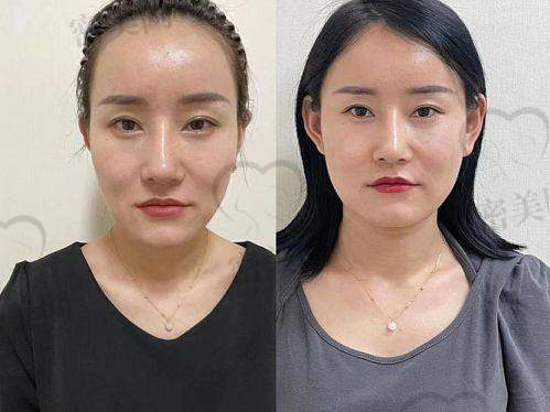 医美项目的风险与注意事项