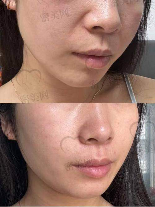 按摩手法：给脸部来个“马杀鸡”