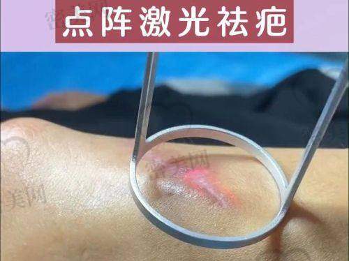 排名第五：深圳富华医疗美容医院 - 医生：唐新辉