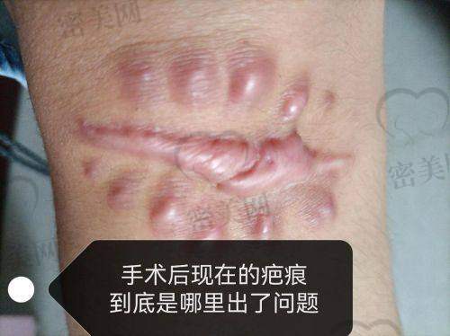 遇见陈业忠医生，曙光初现