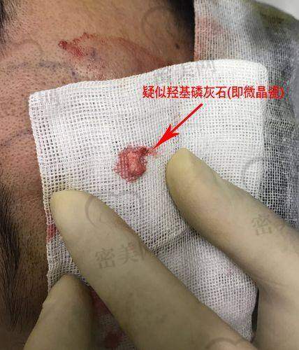 收费标准：性价比高不高？