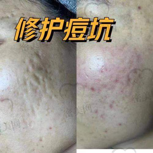 排名第六：杭州艺星医疗美容医院 - 医生：吕敏