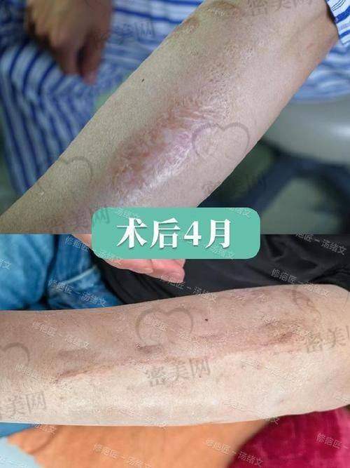 辽阳仁爱医院整形科