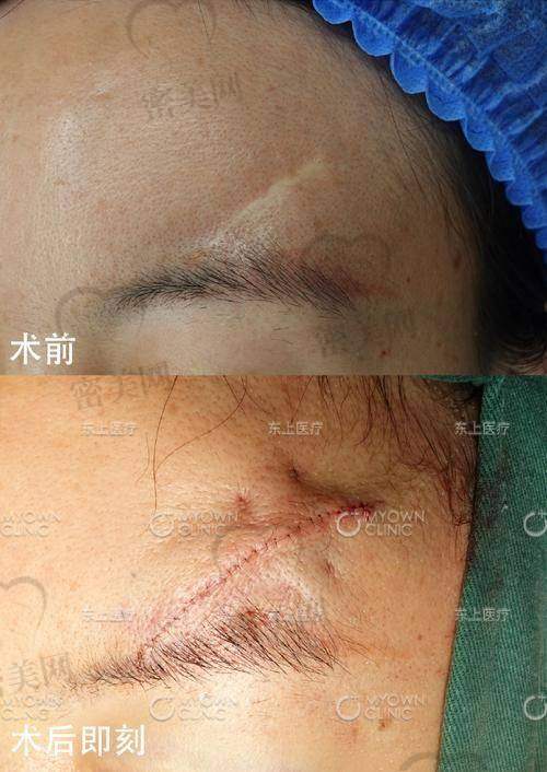 汕头君妍医疗美容医院：定点预约治疗制保障客户体验