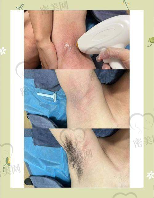重庆美莱整形美容医院