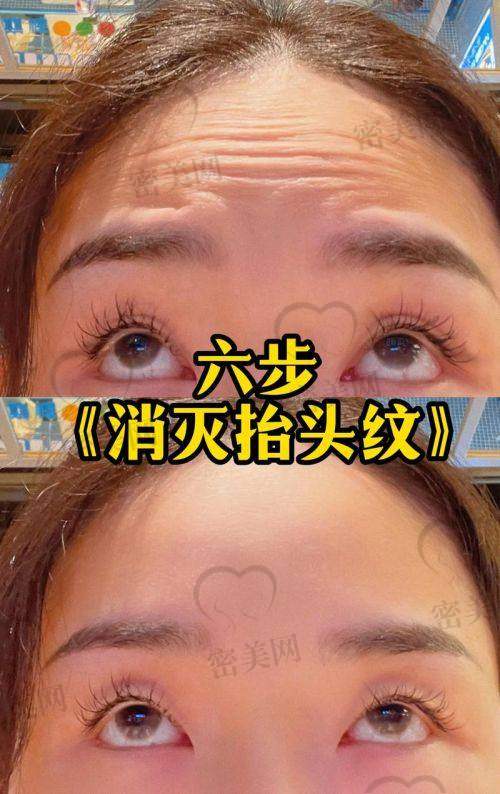 注意事项