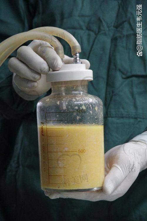 郑州美呗医疗美容医院 - 杨胜发医生