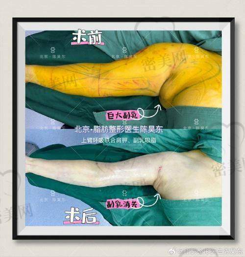 郑州辰星医疗美容医院 - 李钢医生