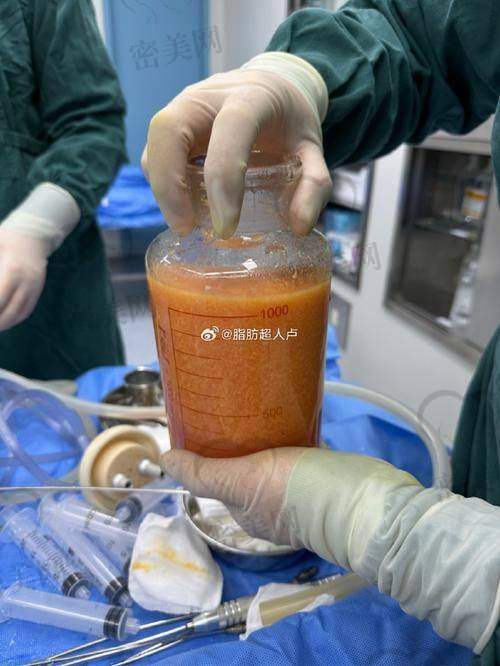 郑州美莱医疗美容医院 - 王洪医生