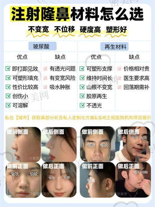 修复时间要多久？