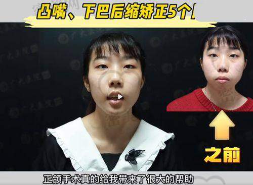 杨美芳医生口碑怎么样？