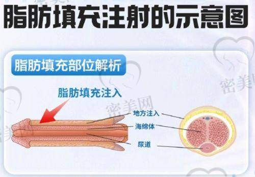 邓飞艳医生擅长项目：