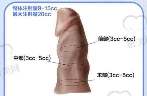 周叶医生怎么预约挂号？