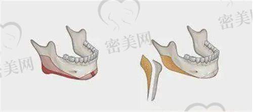 徐翔医生荣誉资质：