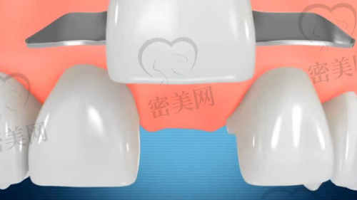 上海泰康拜博博尔口腔门诊部怎么预约挂号？