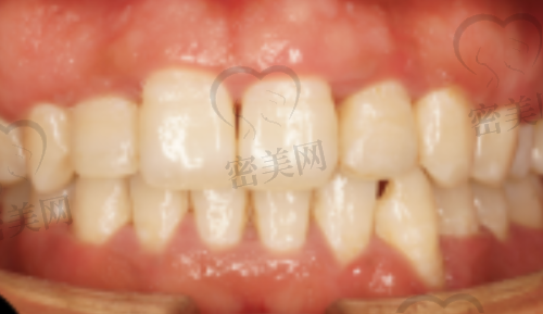 苏州华夏口腔医院治疗项目多吗？实用+医美类均有