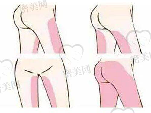 徐怀河鼻修复价格体系：明码标价+后期维养服务全方面
