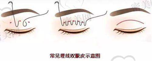 徐霞医生荣誉资质：